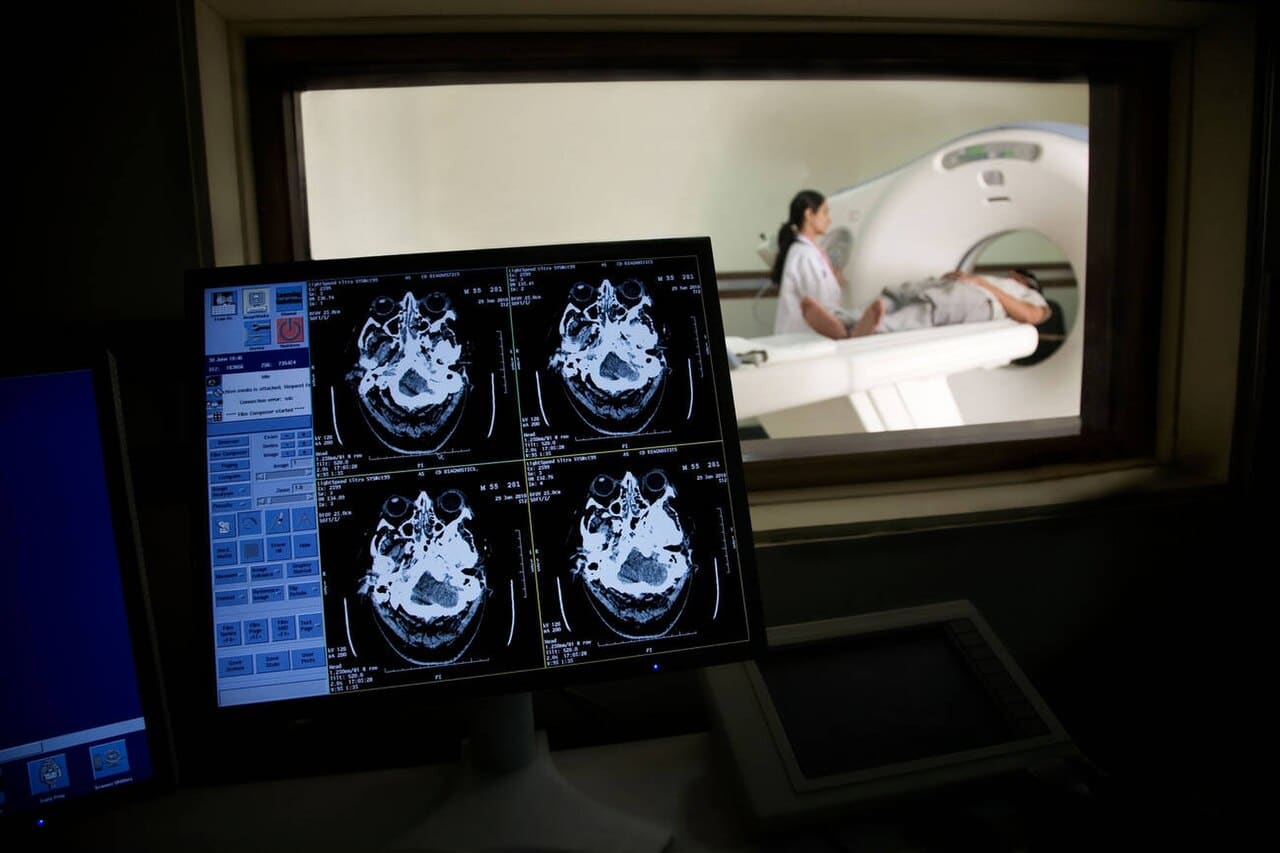Tomografia de crânio, paciente no tomógrafo e imagens no monitor