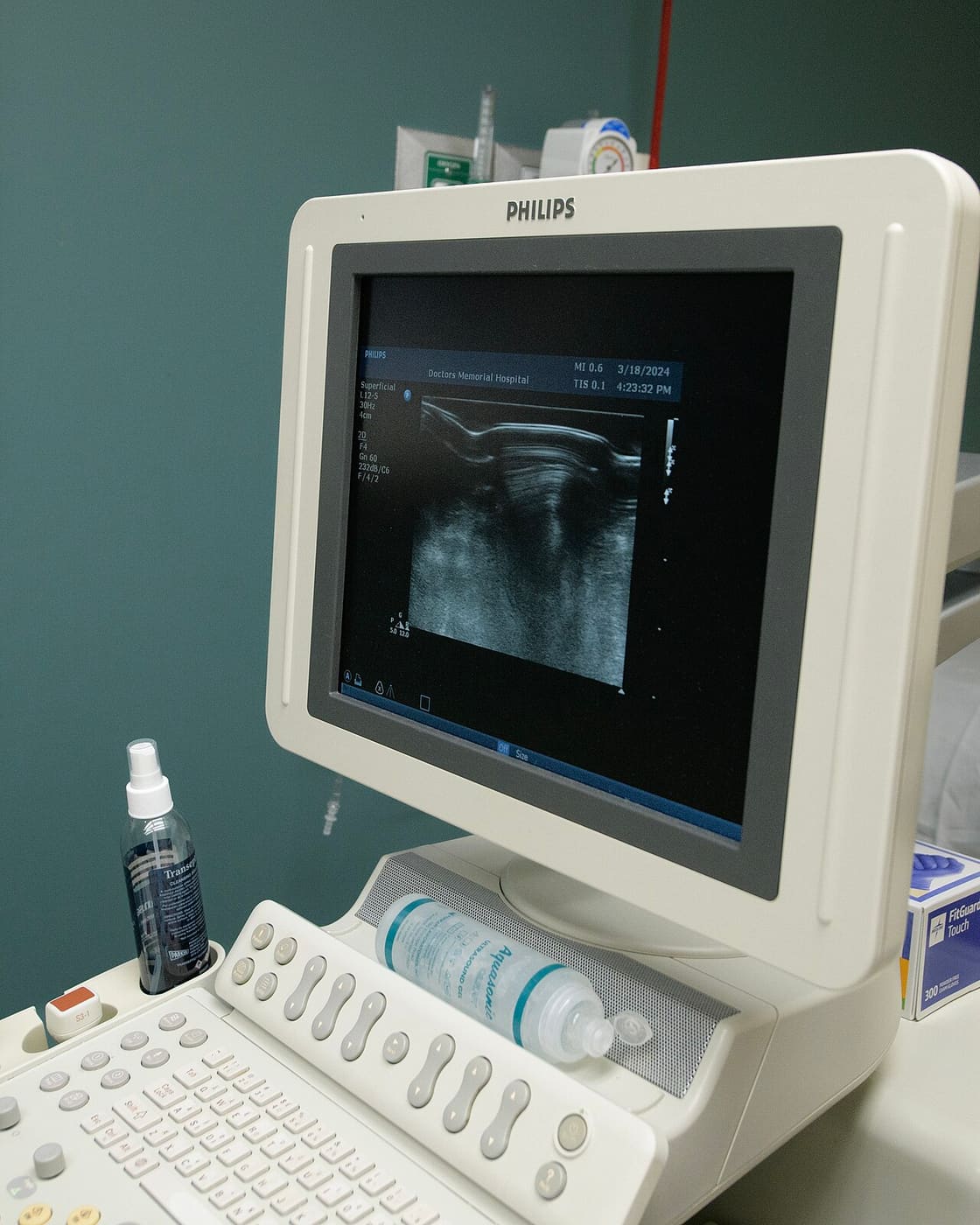 Ultrassom de mamas, equipamento de alta resolução